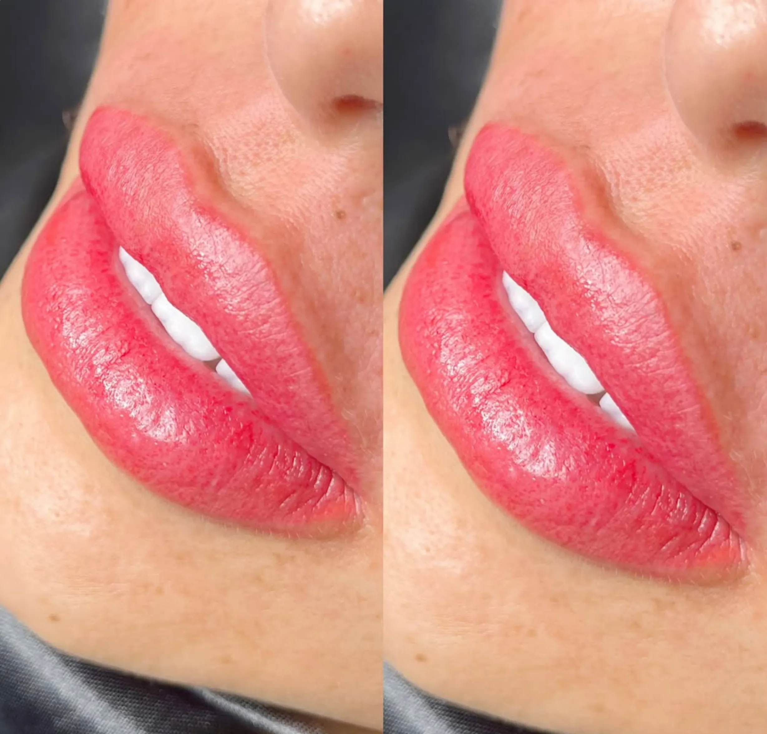 How Many Sessions Are Needed for a Lip Tattoo?