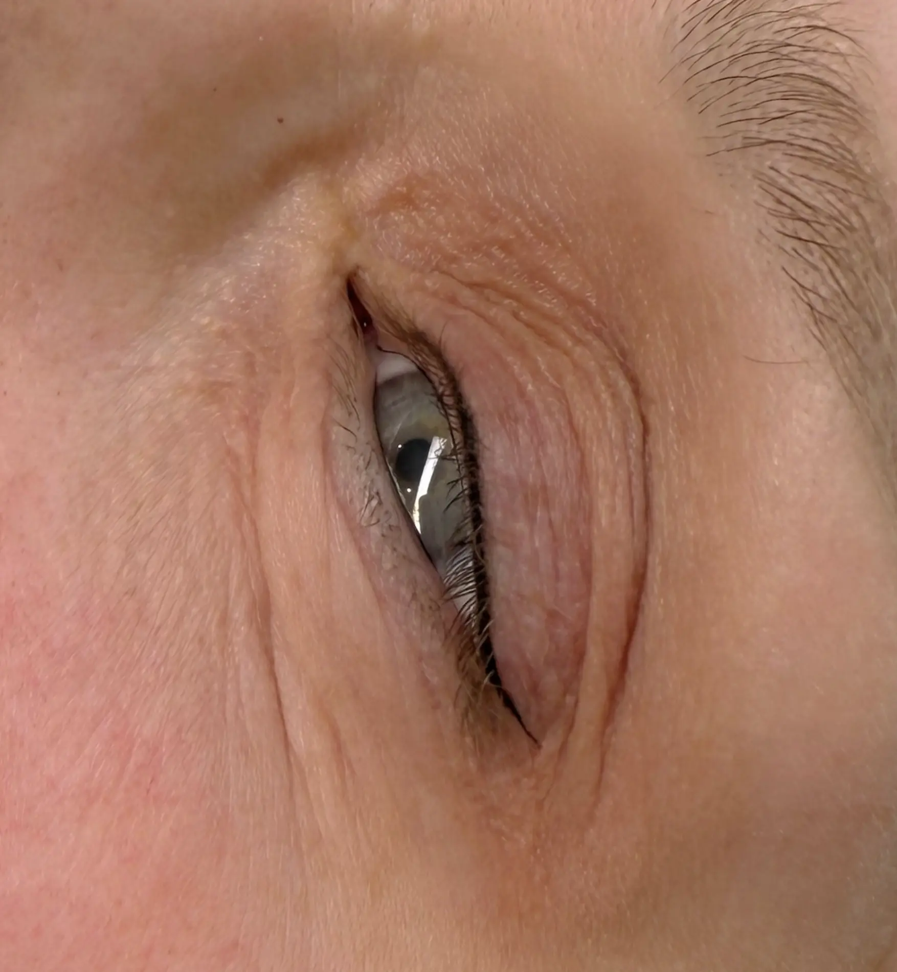 Ghosting phase of eyeliner tattoo